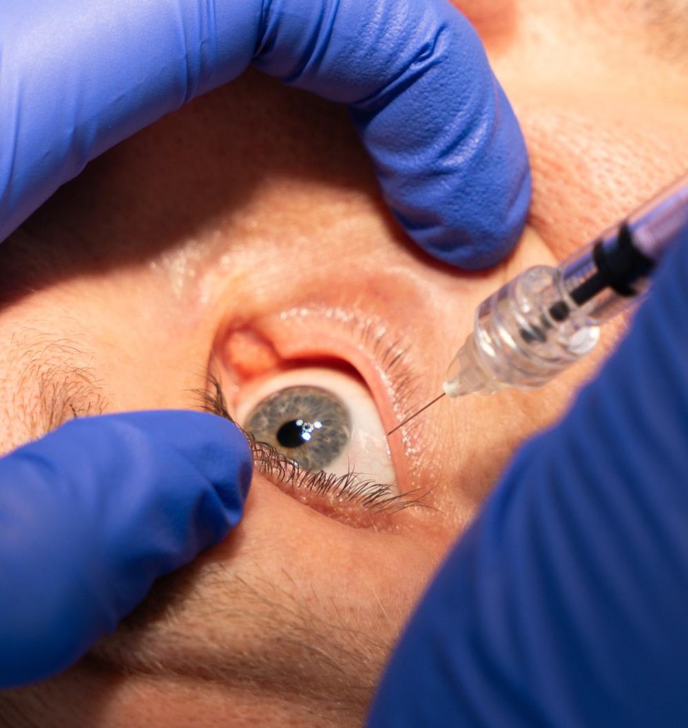 Clinician performing an intravitreal injection
